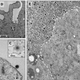 Various images of Yaravirus under an electron microscope
